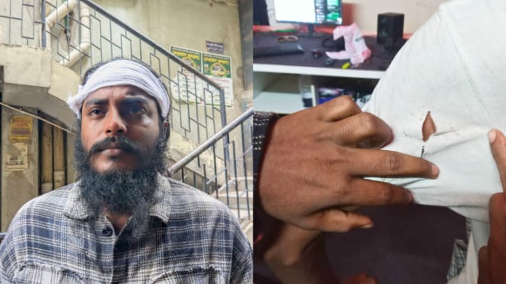 সংগীতশিল্পী তাকবীর হোসেনের ওপর সন্ত্রাসী হামলার ঘটনায় নিন্দা ও উদ্বেগ